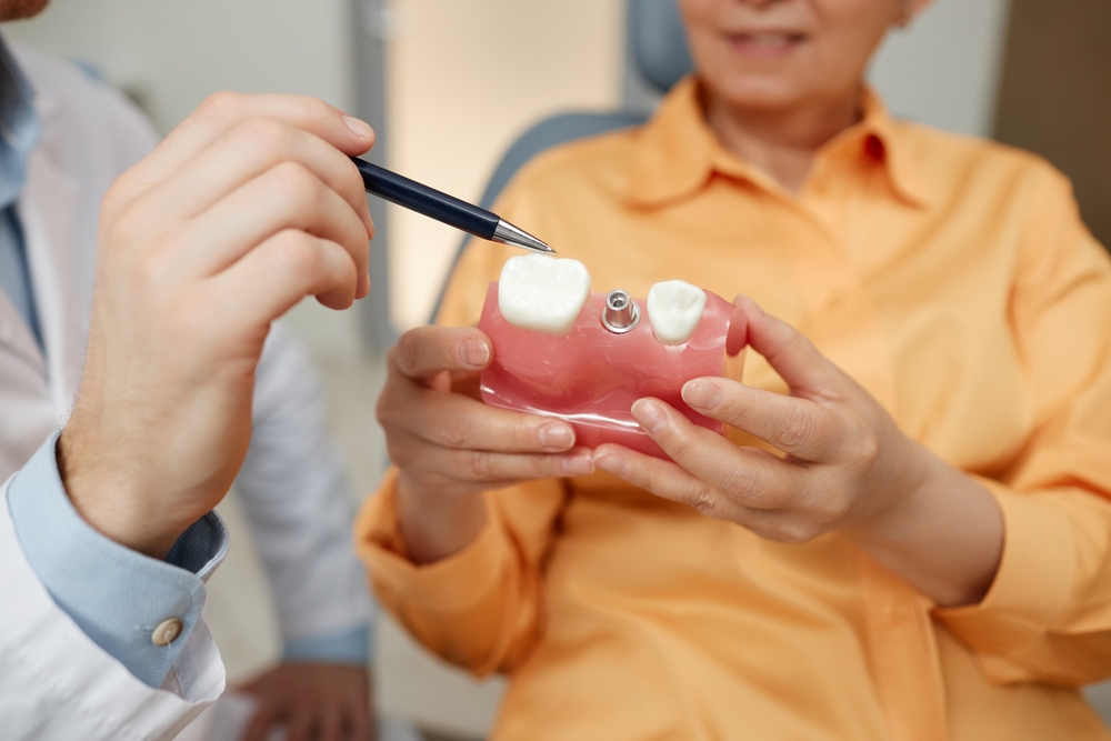 Dentist Explaining Dental Implant Model - Implant-Supported Crowns and Bridges A dentist uses a detailed model to explain the structure and benefits of implant-supported crowns and bridges, emphasizing durable and natural-looking tooth replacement options.